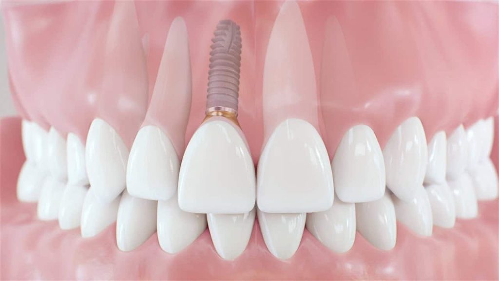 Dental treatment abroad: Budapest, Hungary