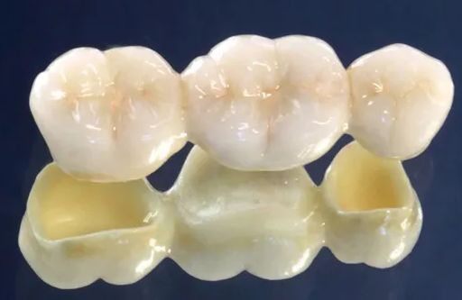 Dental crowns Budapest, Hungary